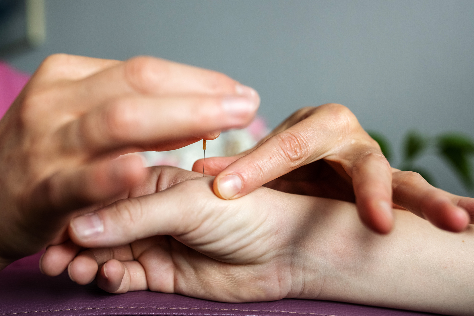 acupuncture needle in hand